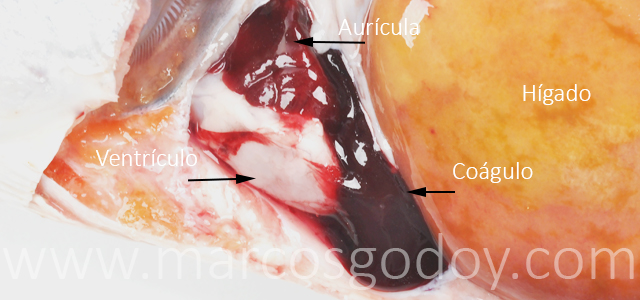 Hemopericardio Salmon coho III