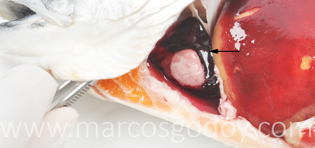 Hemopericardio Salmon coho XI