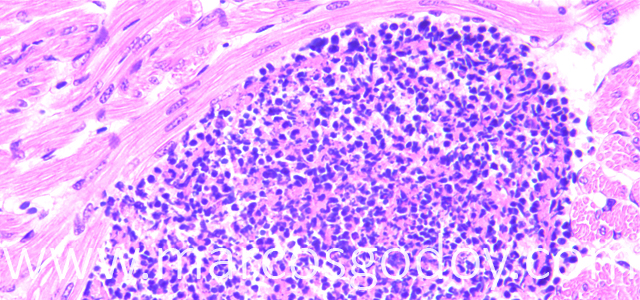 Trombosis 400X VI