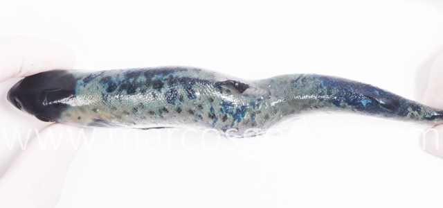 Escoliosis cifosis lordosis IX