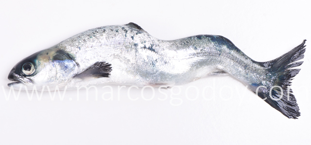 Escoliosis cifosis lordosis VII