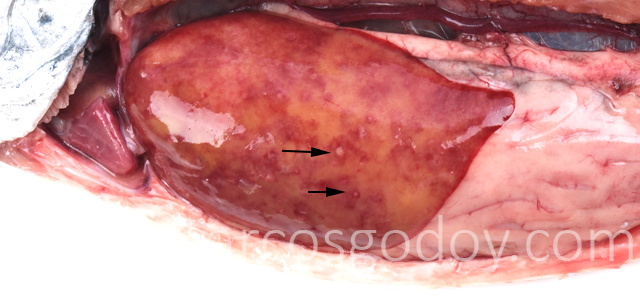 Hepatitis granulomatosa II