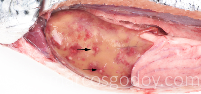 Hepatitis granulomatosa III