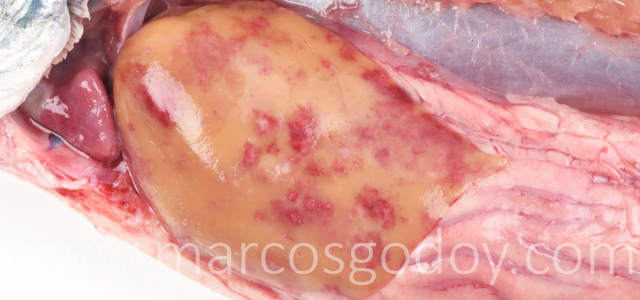 Hepatitis granulomatosa IV