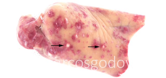Hepatitis granulomatosa VII