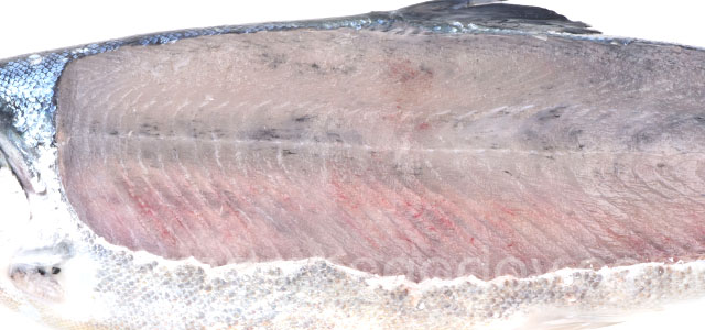 Melanosis difusa smolt XV