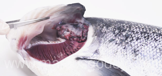 Tumor branquial