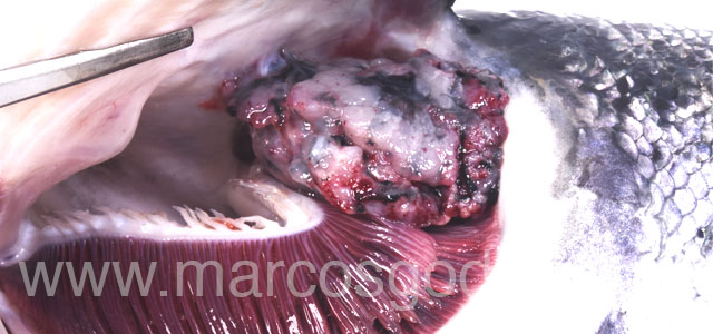 Tumor craneal 2