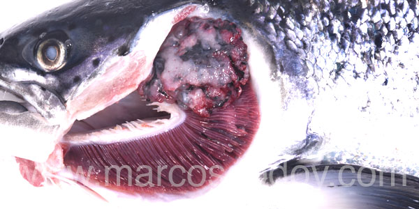 Tumor craneal 4