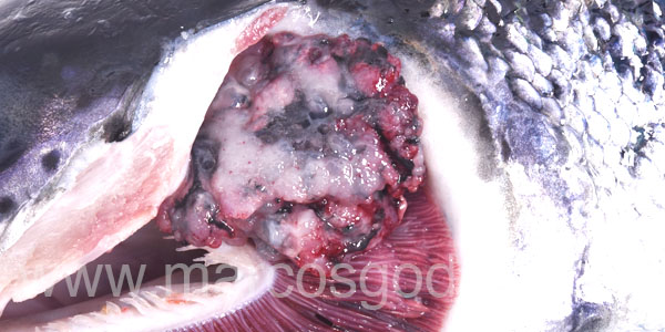 Tumor craneal 5