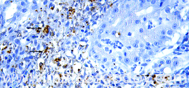 Gastritis IHQ Ps 630 IV
