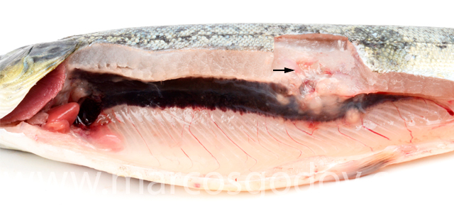 Necrosis muscular Exophiala IV
