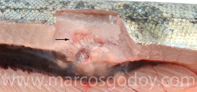 Necrosis muscular Exophiala V