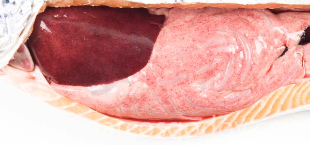 Hemorragia visceral V
