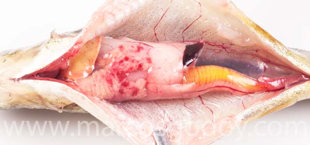 Hemorragia visceral X
