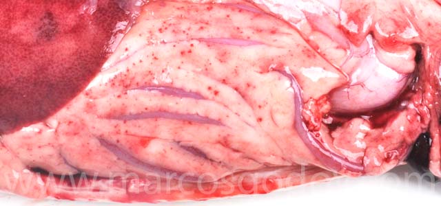 Hemorragia visceral XIII