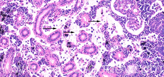 Oedema kidney 200X I