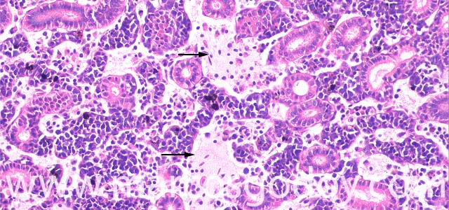 Oedema kidney 200X II