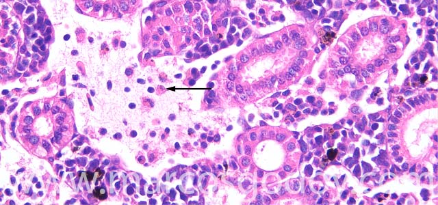 Oedema kidney 400X III