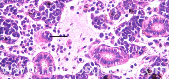 Oedema kidney 400X IV