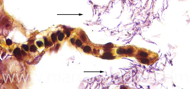 Flavobacterium gill 630X IV