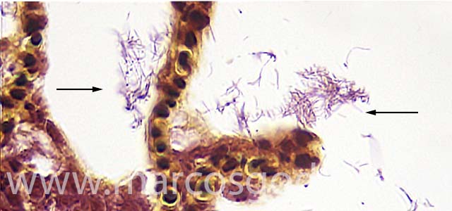 Flavobacterium gill 630X VI