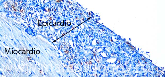 IHQ Piscirickettisasalmonis 200X I
