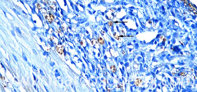 IHQ Piscirickettisasalmonis 400X II