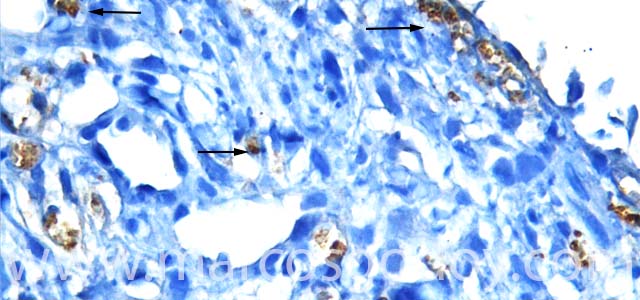 IHQ Piscirickettisasalmonis 630X III