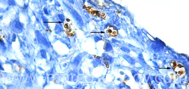 IHQ Piscirickettisasalmonis 630X IV