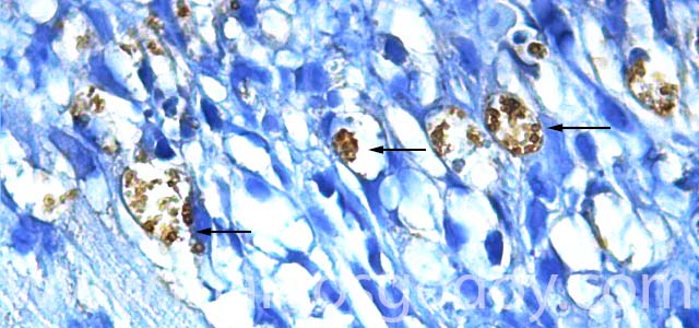 IHQ Piscirickettisasalmonis 630X V