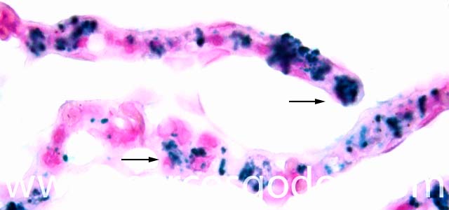IHQ R. salmoninarum 1000X IX
