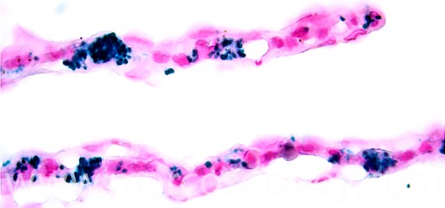 IHQ R. salmoninarum 1000X XI