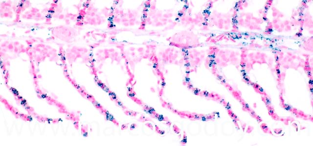 IHQ R. salmoninarum 200X I