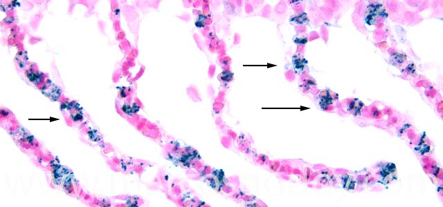 IHQ R. salmoninarum 400X II