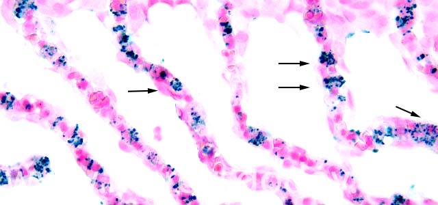 IHQ R. salmoninarum 400X III