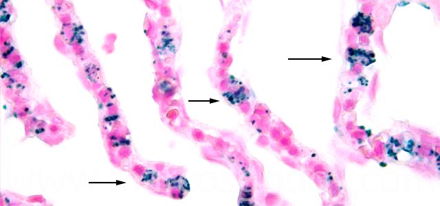 IHQ R. salmoninarum 630X IV