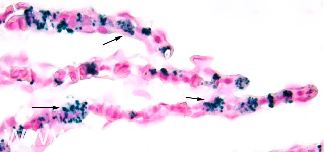 IHQ R. salmoninarum 630X V
