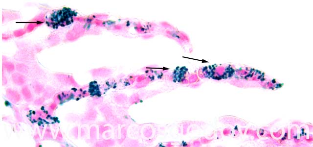 IHQ R. salmoninarum 630X VI