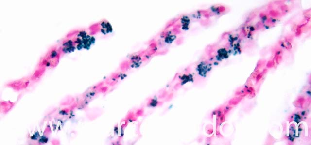 IHQ R. salmoninarum 630X VII