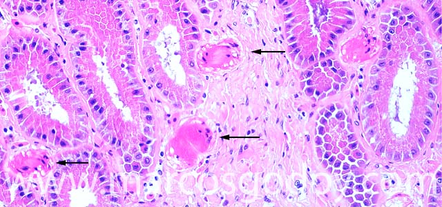 Estomago hyaline 200X II