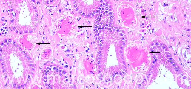 Estomago hyaline 200X III