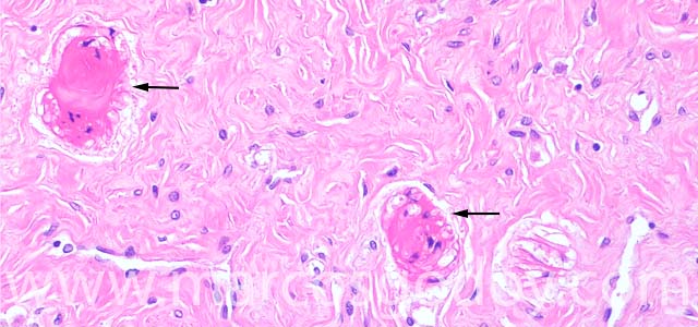 Estomago hyaline 200X IV