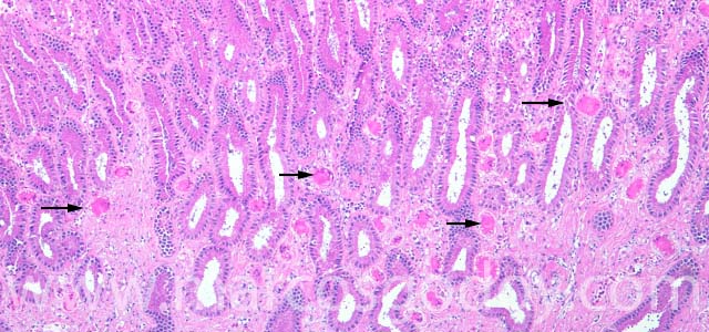 Estomago hyaline 40X