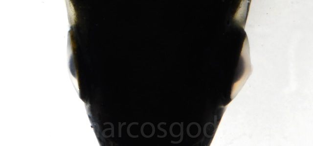 Queratotocono opacidad ocular XI