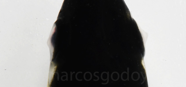 Queratotocono opacidad ocular XV