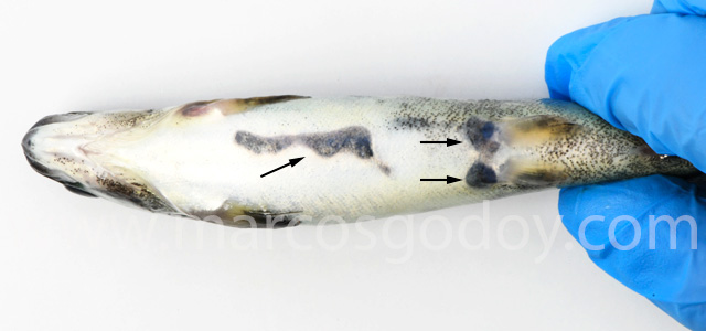 Traumatic melanosis III