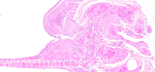 Dermatisis articular I