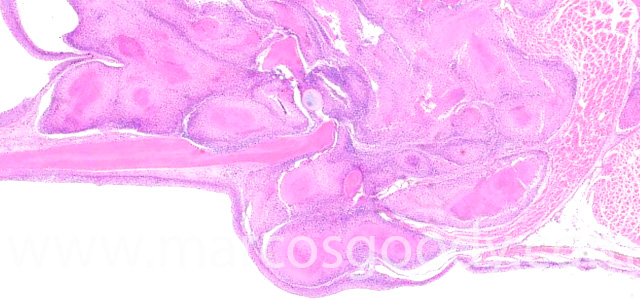 Dermatisis articular II