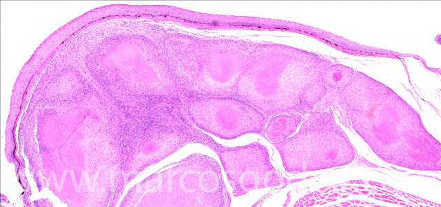 Dermatisis articular IV
